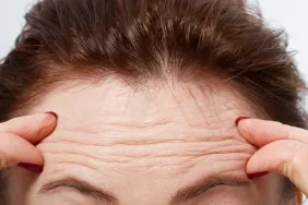 Kırışıklıklar Neden Olur? < Bilgiustam