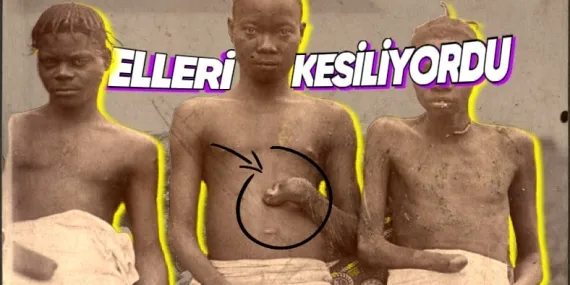 Hitler’den Daha Fazla İnsan Öldürmesine Karşın Onun Kadar Bilinmeyen Acımasız Diktatör: II. Leopold