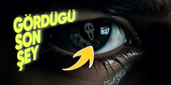 Katili, Kurbanının “Gözündeki Son Görüntüden” Ortaya Çıkarma Eforu: Optografi