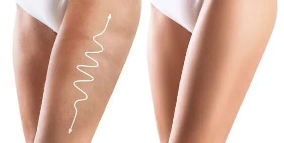 Birkaç basit hareket ile selülitlere veda edin!