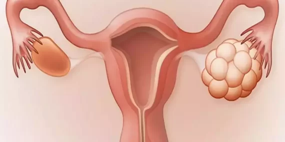 Genç kadınlardaki en yaygın hastalık! Uzmanlar “Aman dikkat!”diyor…