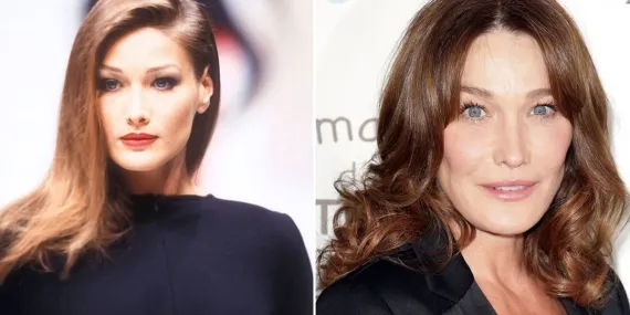 Tek istekleri daha fazla güzel olmaktı… Estetik yüzünden tanınmayacak hale gelen ünlüler…