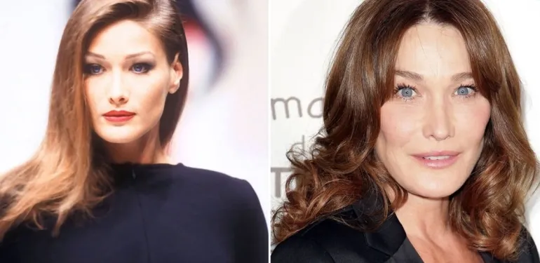 Tek istekleri daha fazla güzel olmaktı… Estetik yüzünden tanınmayacak hale gelen ünlüler…