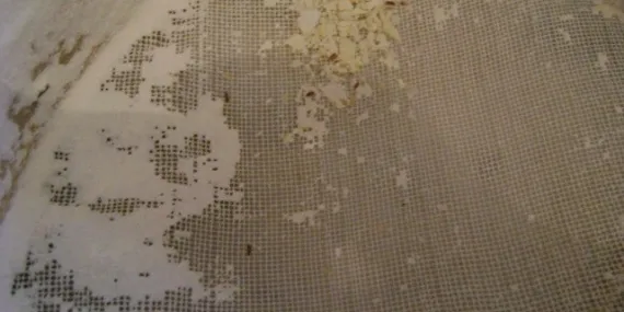 Unlarınızın böceklenmesine son! Tek damla ile sorunu kökten çözün…