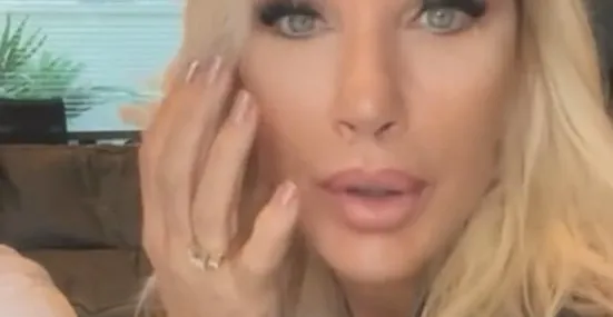 Yüzüne sünnet derisi enjekte ettirdiğini açıkladı! Her şey genç görünmek için…