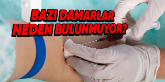 Bazılarımızın Damarları, Kan Verme Sırasında Neden Bu Kadar Zor Bulunur?
