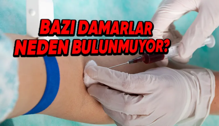 Bazılarımızın Damarları, Kan Verme Sırasında Neden Bu Kadar Zor Bulunur?