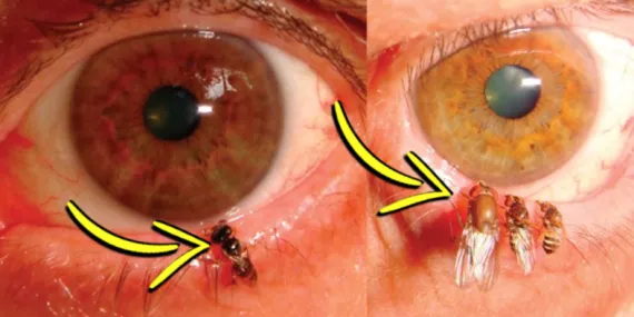 Bilim İnsanları Yaptıkları Bir Çalışmada Arıları Gözlerine Yerleştirerek Ne Amaçlamıştı? Arkasında Rahatsız Edici Bir Gerçek Yatıyor