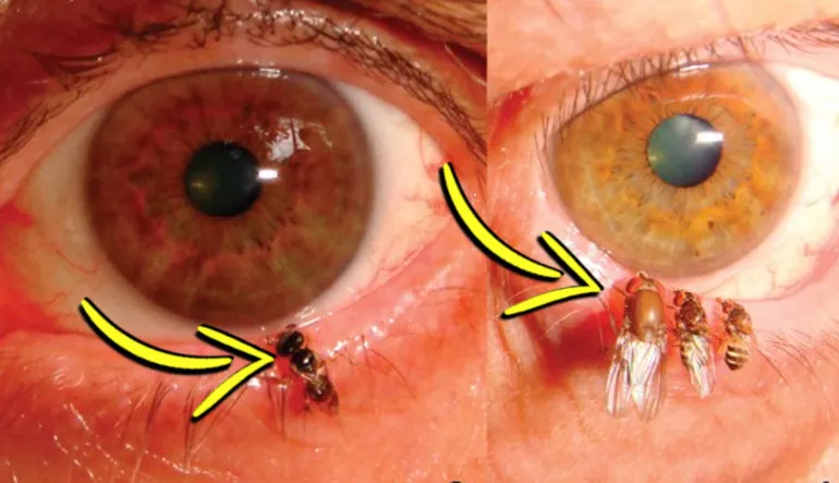 Bilim İnsanları Yaptıkları Bir Çalışmada Arıları Gözlerine Yerleştirerek Ne Amaçlamıştı? Arkasında Rahatsız Edici Bir Gerçek Yatıyor