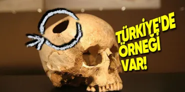 eski-donemlerde-neden-insanlarin-kafasina-koca-koca-delikler-aciliyordu-gunumuzde-de-yapilabiliyor-FNpIxdqA.jpg