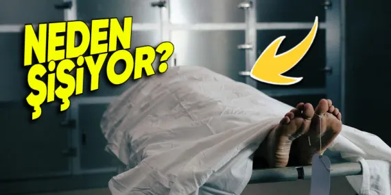 İnsan Vücudu Öldükten Sonra Neden Balon Gibi Şişiyor? Bazen “Güm” Diye Patlayabiliyormuş!
