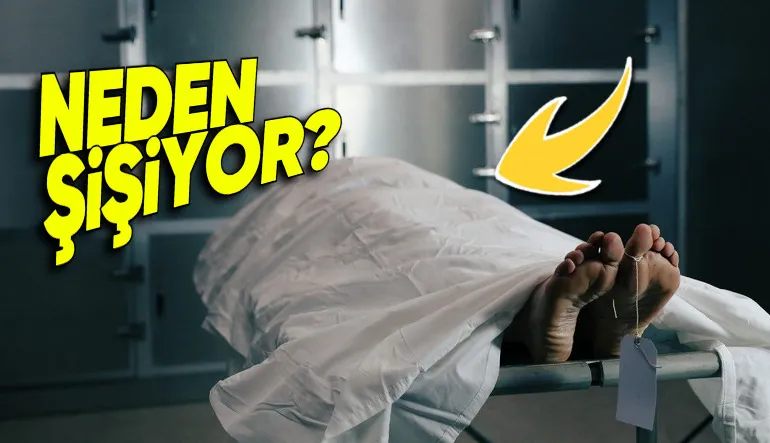 İnsan Vücudu Öldükten Sonra Neden Balon Gibi Şişiyor? Bazen “Güm” Diye Patlayabiliyormuş!