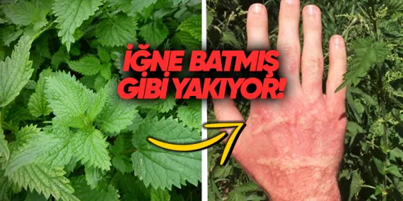 Isırgan Otu Neden Cildimizi Sanki İğne Batmışçasına Yakar?