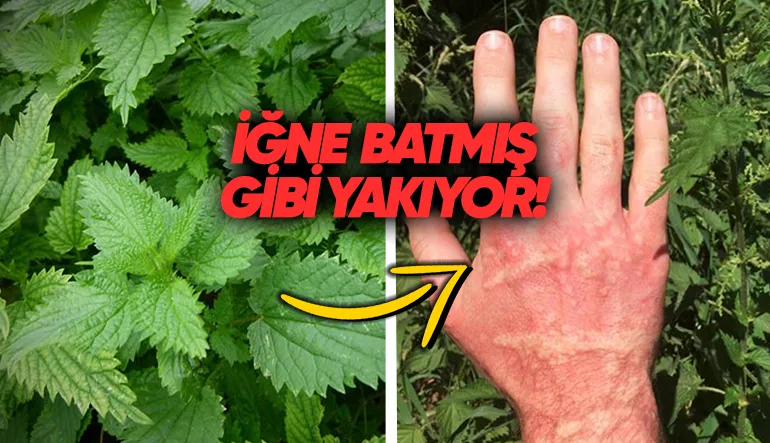 Isırgan Otu Neden Cildimizi Sanki İğne Batmışçasına Yakar?