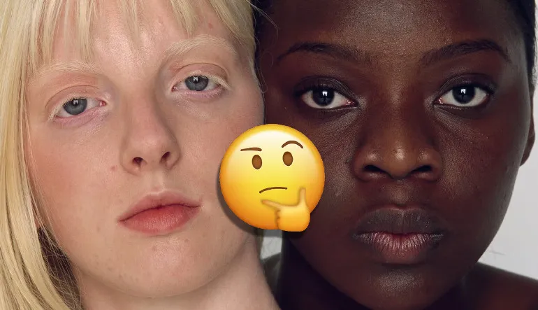 Ten Rengimiz Neden Tek Bir Renk Değil de Siyah ve Beyaz Olarak Evrimleşti? Şu An da Maruz Kaldığımız Bir Şey Yüzündenmiş!