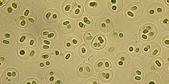 Yapay Tatlandırıcılar, Mikroorganizmaların Felaketi Olabilir (Bizim de)