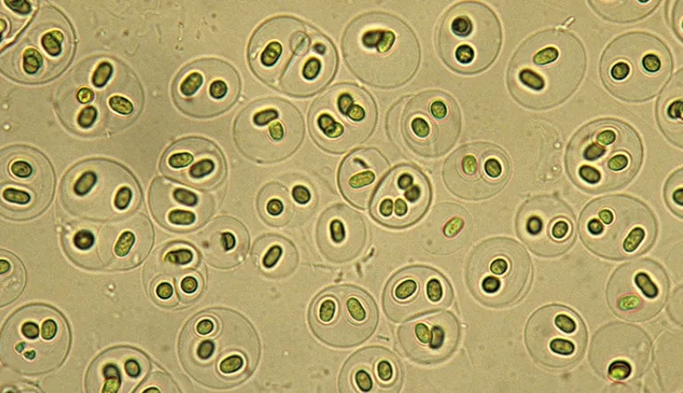 Yapay Tatlandırıcılar, Mikroorganizmaların Felaketi Olabilir (Bizim de)
