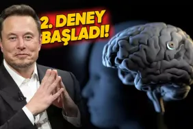 elon-musk-neuralinkin-ikinci-kez-bir-insanin-beynine-cip-yerlestirdigini-acikladi-ry1gpqHj.jpg