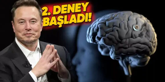 Elon Musk, Neuralink’in İkinci Kez Bir İnsanın Beynine Çip Yerleştirdiğini Açıkladı!