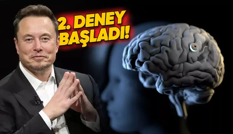Elon Musk, Neuralink’in İkinci Kez Bir İnsanın Beynine Çip Yerleştirdiğini Açıkladı!